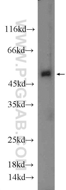 Western Blot (WB) analysis of mouse liver tissue using BEND5 Polyclonal antibody (20931-1-AP)