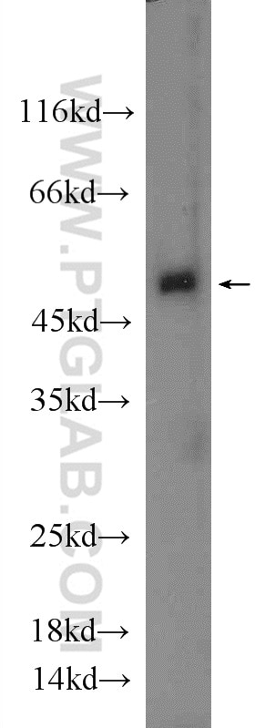 WB analysis of mouse liver using 20931-1-AP