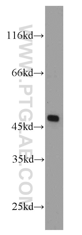 Western Blot (WB) analysis of mouse liver tissue using BEND5 Polyclonal antibody (20931-1-AP)