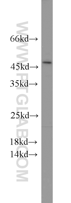 Western Blot (WB) analysis of Raji cells using BEND5 Polyclonal antibody (20931-1-AP)