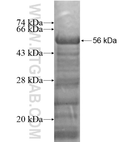 BEND5 fusion protein Ag14790 SDS-PAGE BEND5 fusion protein Ag14790 SDS-PAGE