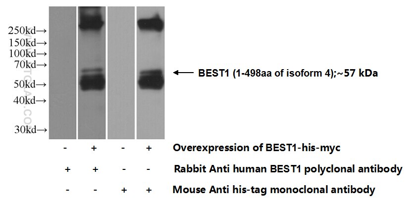 Bestrophin-1 Polyclonal antibody