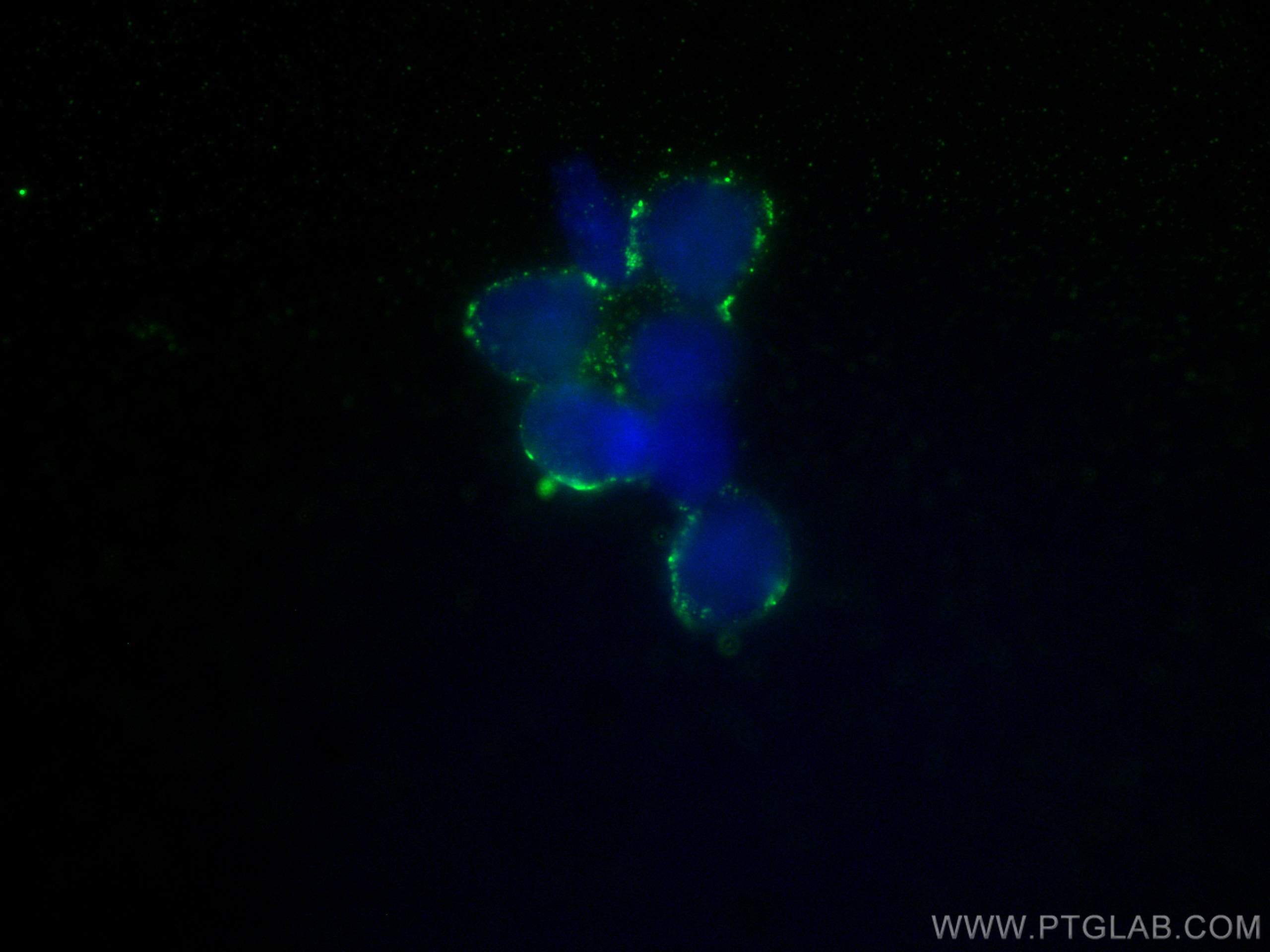 Immunofluorescence (IF) / fluorescent staining of Y79 cells using Bestrophin-1 Monoclonal antibody (60326-1-Ig)