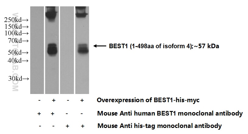 Western Blot (WB) analysis of Transfected HEK-293 cells using Bestrophin-1 Monoclonal antibody (60326-1-Ig)