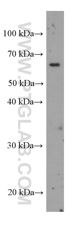 Western Blot (WB) analysis of Y79 cells using Bestrophin-1 Monoclonal antibody (60326-1-Ig)