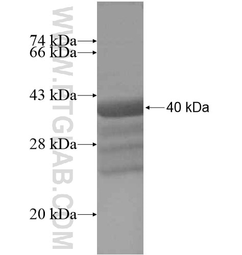 BEST1 fusion protein Ag15129 SDS-PAGE