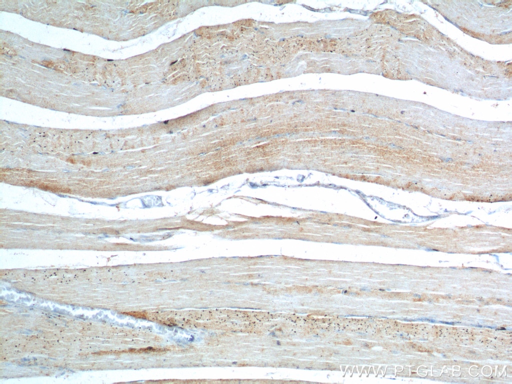 Immunohistochemistry (IHC) staining of human skeletal muscle tissue using Bestrophin-3 Polyclonal antibody (20443-1-AP)