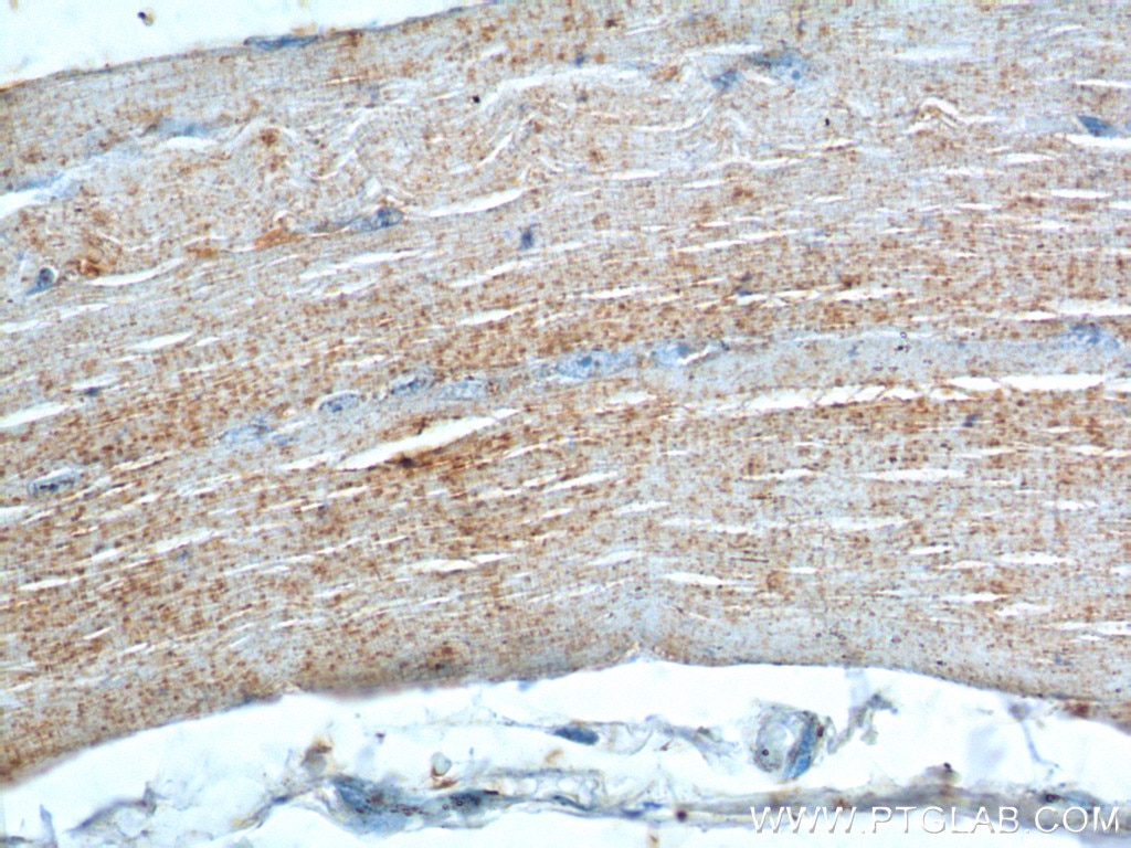 Immunohistochemistry (IHC) staining of human skeletal muscle tissue using Bestrophin-3 Polyclonal antibody (20443-1-AP)