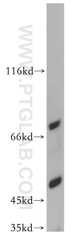 Western Blot (WB) analysis of mouse colon tissue using Bestrophin-3 Polyclonal antibody (20443-1-AP)