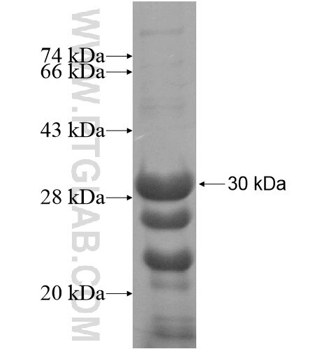 BEST3 fusion protein Ag14255 SDS-PAGE