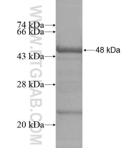 BEST4 fusion protein Ag13015 SDS-PAGE BEST4 fusion protein Ag13015 SDS-PAGE