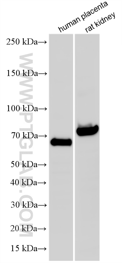 WB analysis using 14134-1-AP (same clone as 14134-1-PBS) Western Blot (WB) analysis of various lysates using Beta ENaC Polyclonal antibody (14134-1-AP)