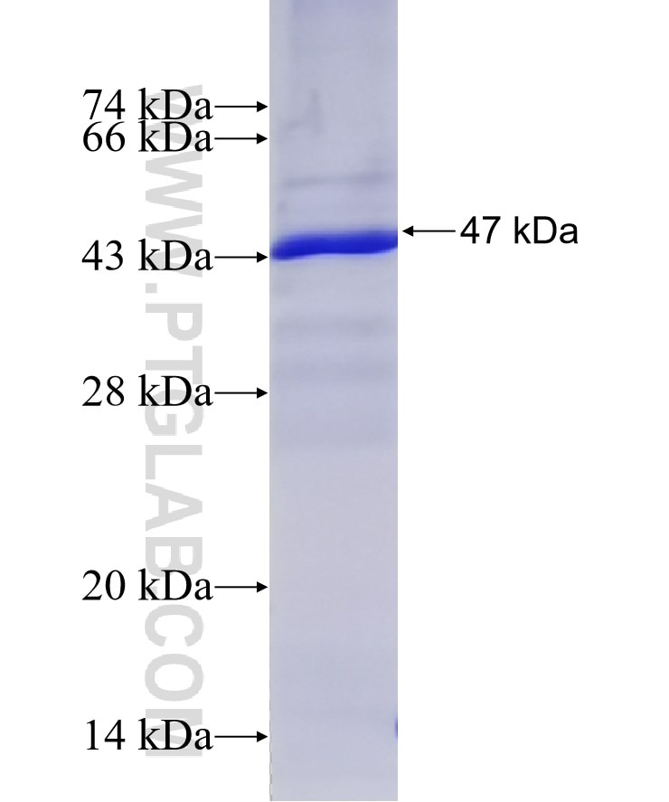 BETA-TRCP,BTRC fusion protein Ag28421 SDS-PAGE