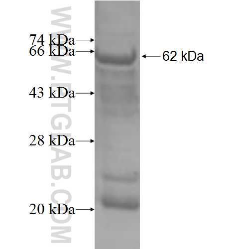 BETA-TRCP,BTRC fusion protein Ag4139 SDS-PAGE