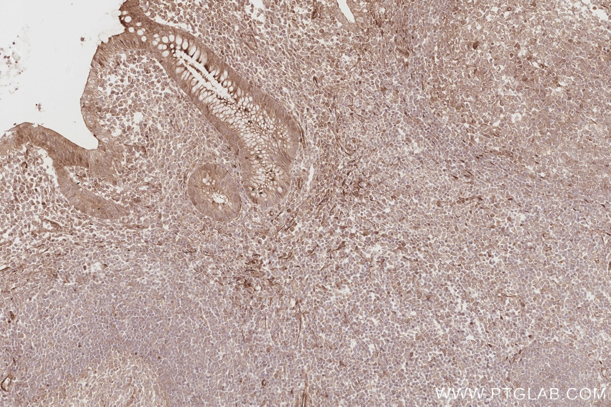 Immunohistochemistry (IHC) staining of human appendicitis tissue using BEX1/2 Polyclonal antibody (12390-1-AP)