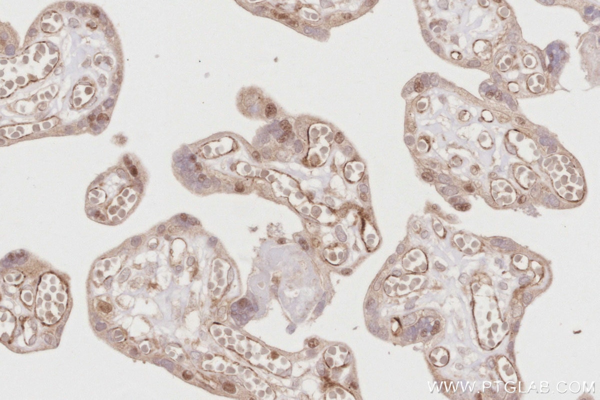Immunohistochemistry (IHC) staining of human placenta tissue using BEX1/2 Polyclonal antibody (12390-1-AP)