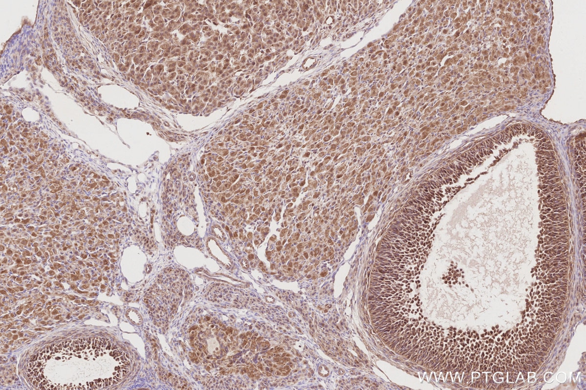 Immunohistochemistry (IHC) staining of rat ovary tissue using BEX1/2 Polyclonal antibody (12390-1-AP)