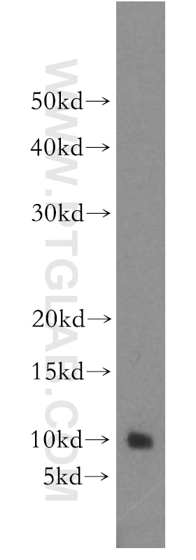 Western Blot (WB) analysis of human brain tissue using BEX1/2 Polyclonal antibody (12390-1-AP)