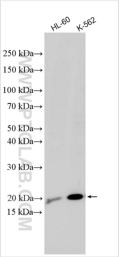 Western Blot (WB) analysis of various lysates using BEX4 Polyclonal antibody (27525-1-AP)