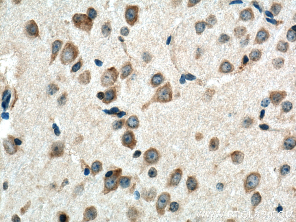 Immunohistochemistry (IHC) staining of mouse brain tissue using BEX5 Polyclonal antibody (25281-1-AP)