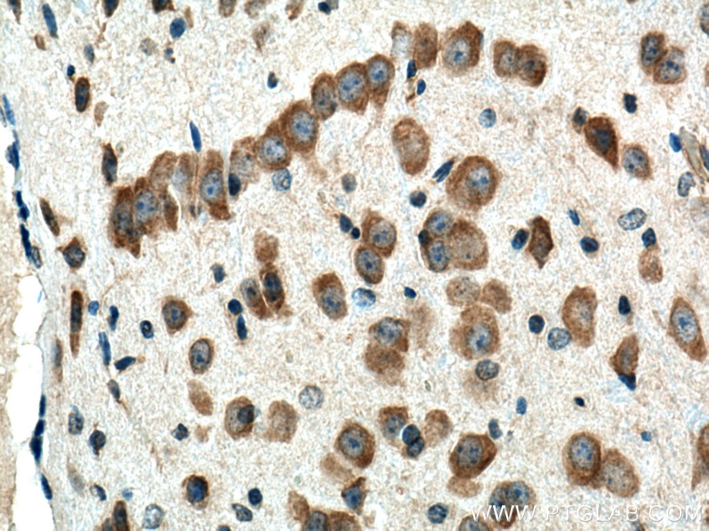 Immunohistochemistry (IHC) staining of mouse brain tissue using BEX5 Polyclonal antibody (25281-1-AP)