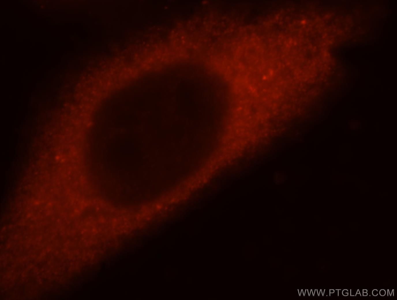 Immunofluorescence (IF) / fluorescent staining of HeLa cells using Filensin Polyclonal antibody (17492-1-AP)