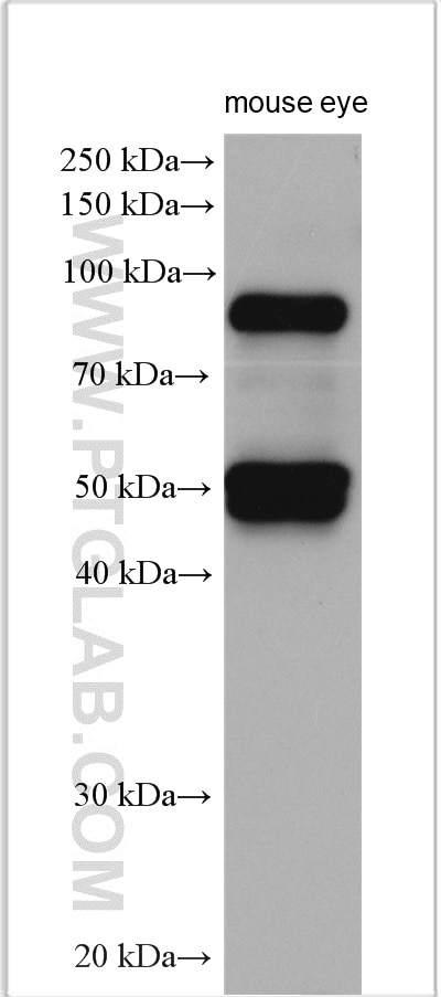 Western Blot (WB) analysis of various lysates using Filensin Polyclonal antibody (17492-1-AP)