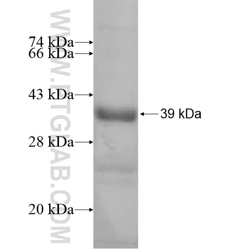 BFSP1 fusion protein Ag11620 SDS-PAGE
