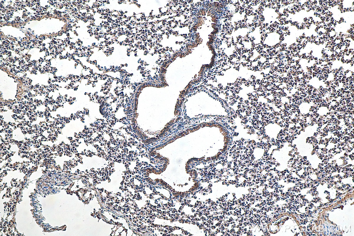 Immunohistochemistry (IHC) staining of mouse lung tissue using Osteocalcin Polyclonal antibody (16157-1-AP)