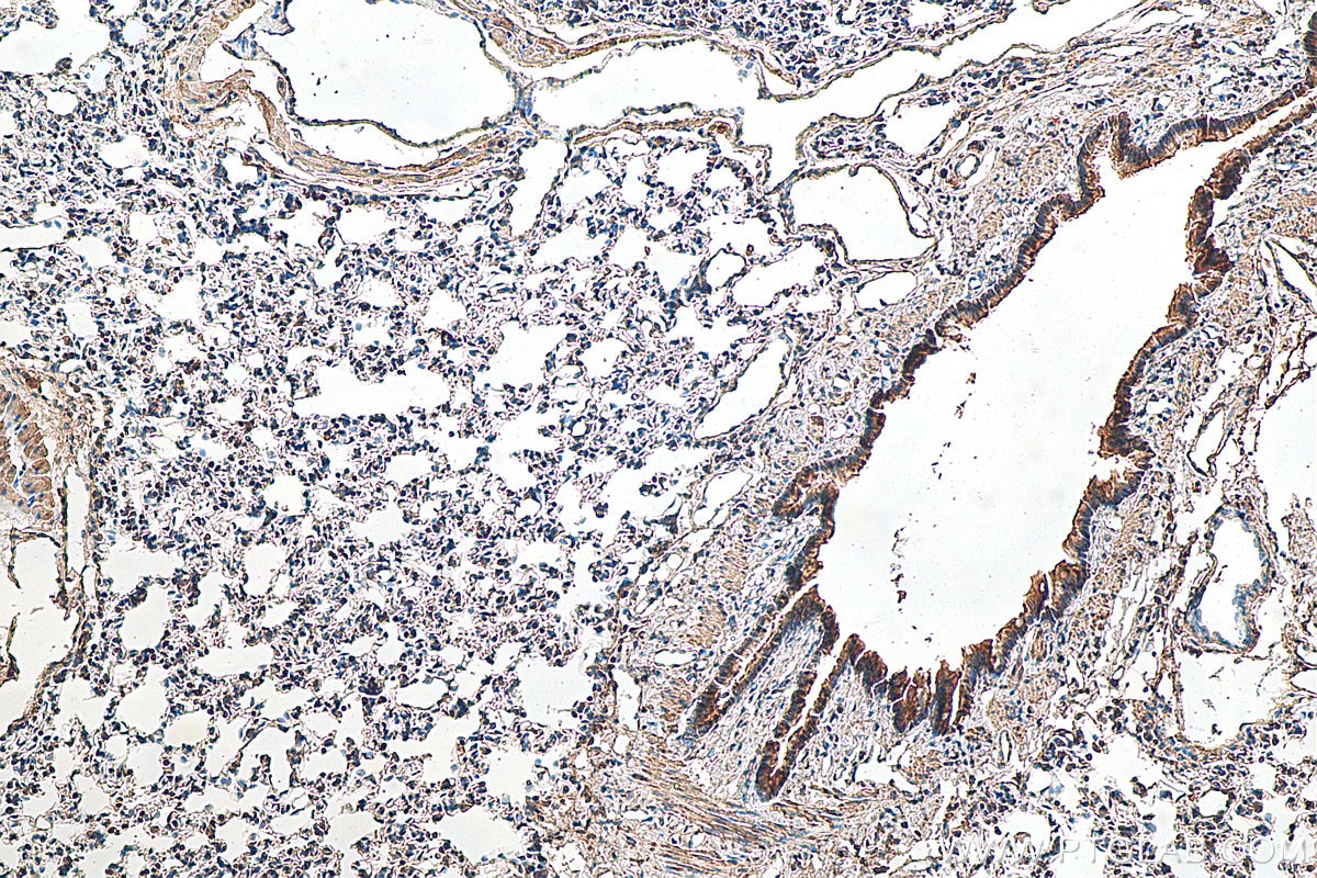 Immunohistochemistry (IHC) staining of rat lung tissue using Osteocalcin Polyclonal antibody (16157-1-AP)