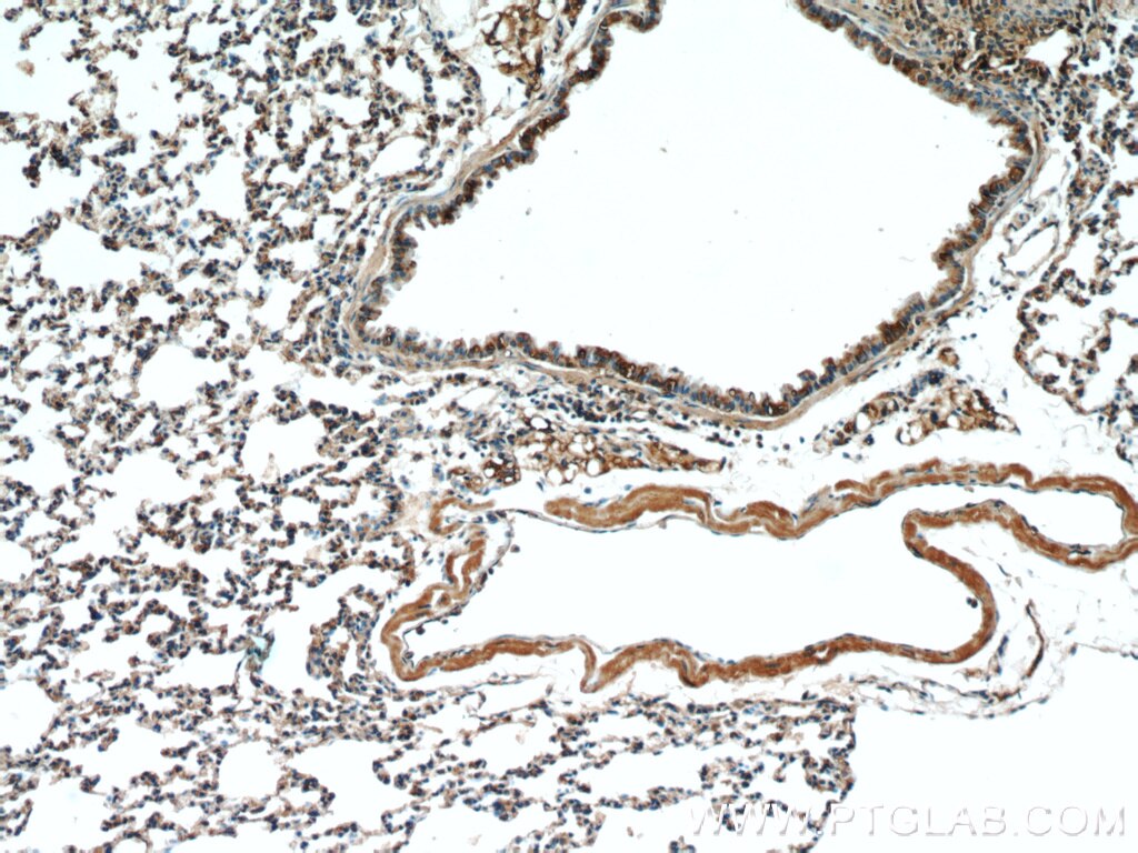 Immunohistochemistry (IHC) staining of mouse lung tissue using Osteocalcin Polyclonal antibody (16157-1-AP)