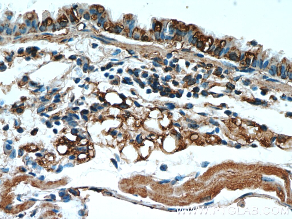 IHC staining of mouse lung using 16157-1-AP