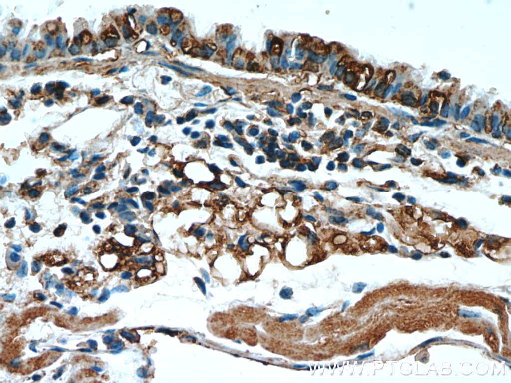 Immunohistochemistry (IHC) staining of mouse lung tissue using Osteocalcin Polyclonal antibody (16157-1-AP)