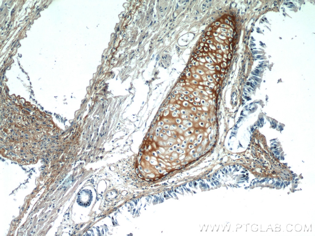 IHC staining of human lung using 16409-1-AP