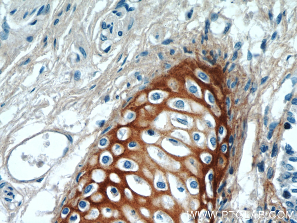 Immunohistochemistry (IHC) staining of human lung tissue using Biglycan Polyclonal antibody (16409-1-AP)