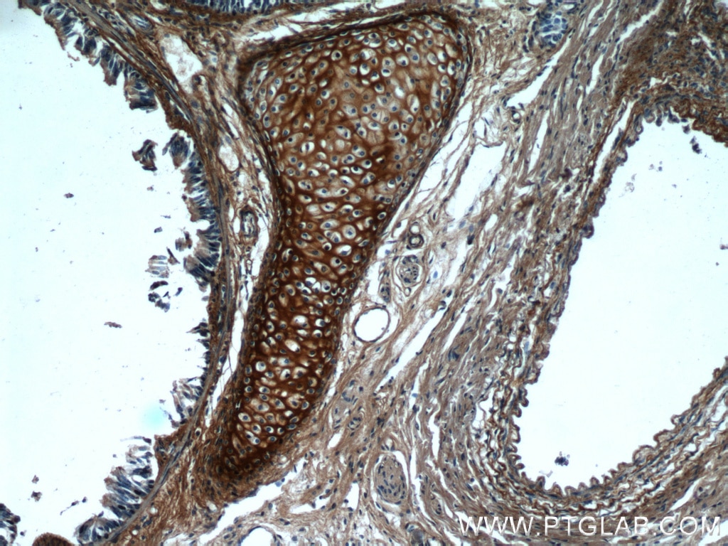 Immunohistochemistry (IHC) staining of human lung tissue using Biglycan Polyclonal antibody (16409-1-AP)