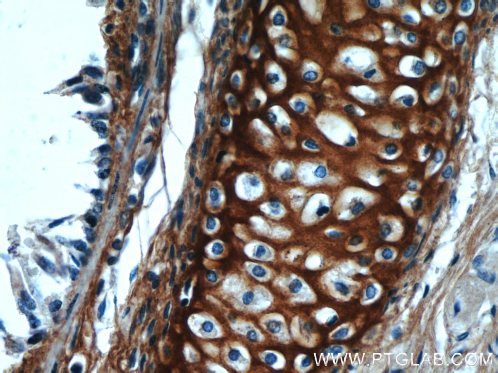 IHC staining of human lung using 16409-1-AP