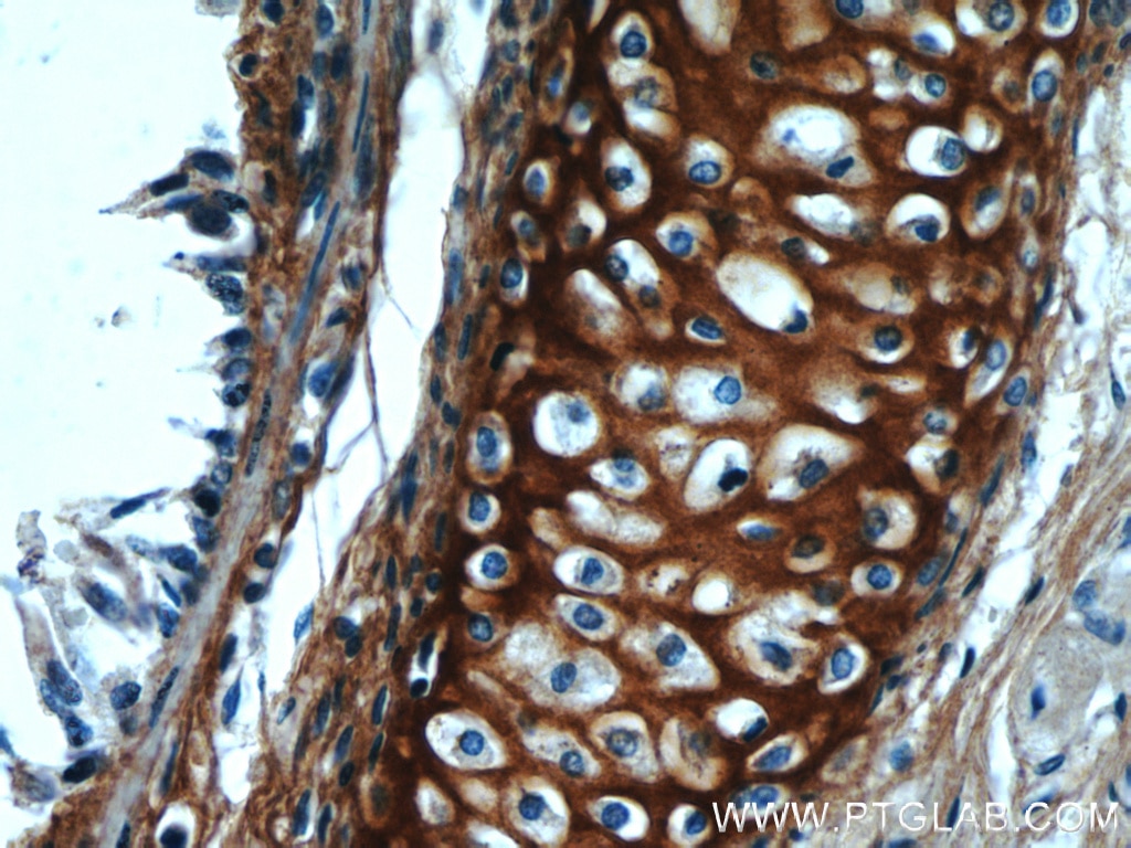 Immunohistochemistry (IHC) staining of human lung tissue using Biglycan Polyclonal antibody (16409-1-AP)