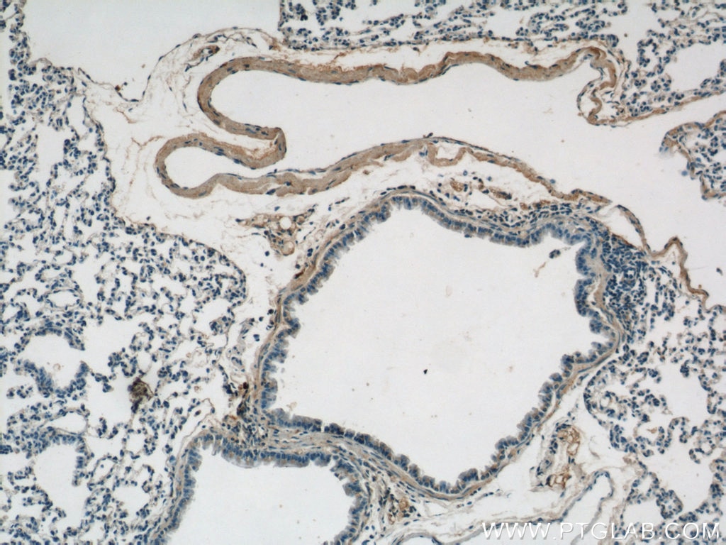 IHC staining of mouse lung using 16409-1-AP