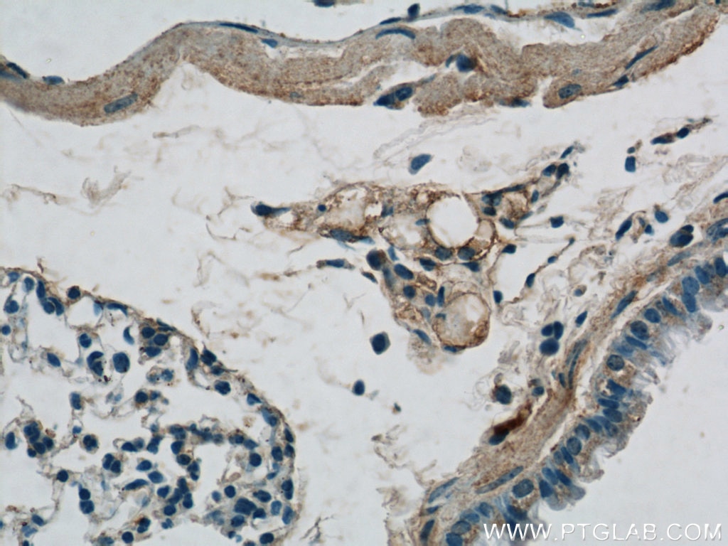 Immunohistochemistry (IHC) staining of mouse lung tissue using Biglycan Polyclonal antibody (16409-1-AP)