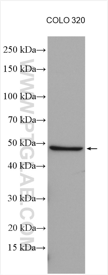 Western Blot (WB) analysis of various lysates using Biglycan Polyclonal antibody (16409-1-AP)