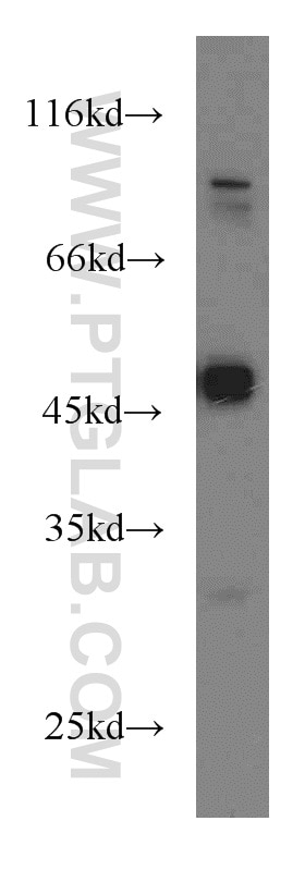 Western Blot (WB) analysis of HeLa cells using Biglycan Polyclonal antibody (16409-1-AP)