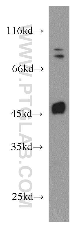 Western Blot (WB) analysis of HepG2 cells using Biglycan Polyclonal antibody (16409-1-AP)