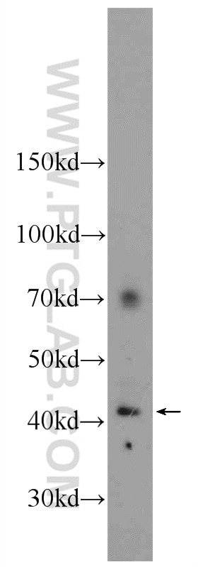 Western Blot (WB) analysis of mouse skeletal muscle tissue using Biglycan Polyclonal antibody (16409-1-AP)