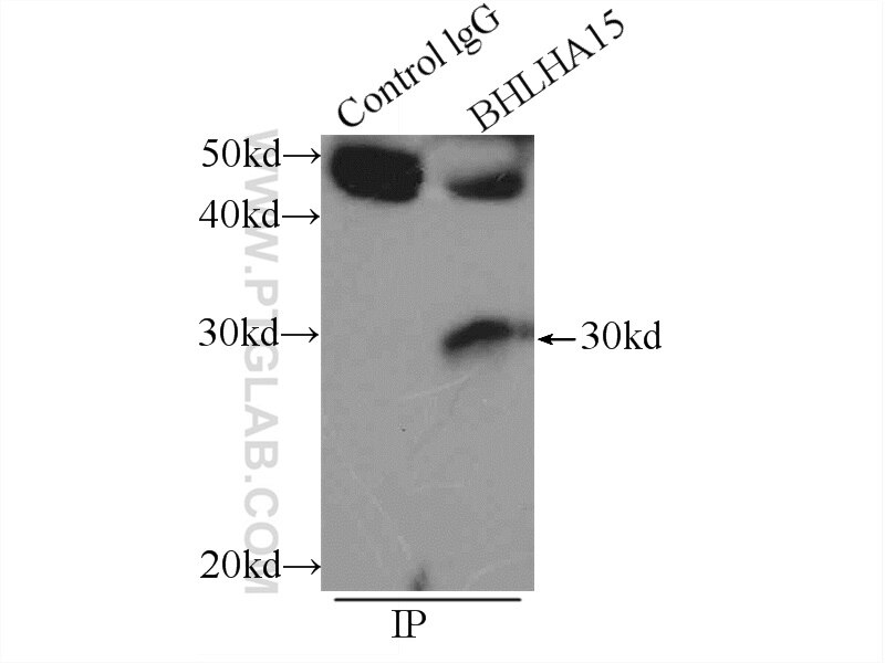 IP experiment of mouse liver using 25140-1-AP