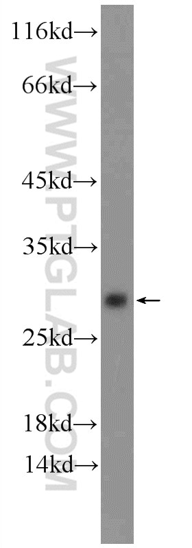 Western Blot (WB) analysis of mouse liver tissue using MIST1 Polyclonal antibody (25140-1-AP)