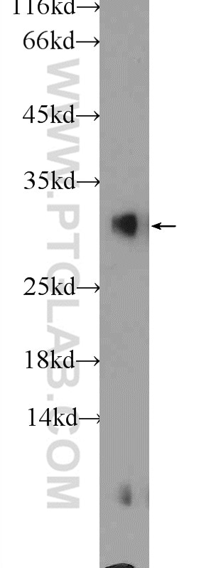 Western Blot (WB) analysis of rat pancreas tissue using MIST1 Polyclonal antibody (25140-1-AP)