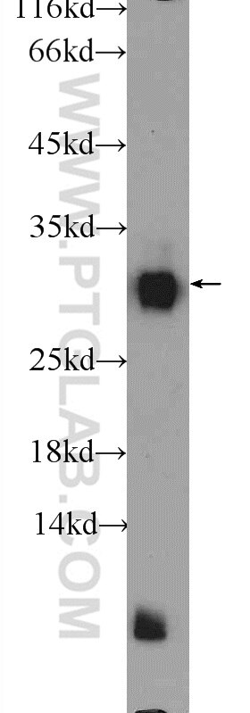 Western Blot (WB) analysis of rat pancreas tissue using MIST1 Polyclonal antibody (25140-1-AP)