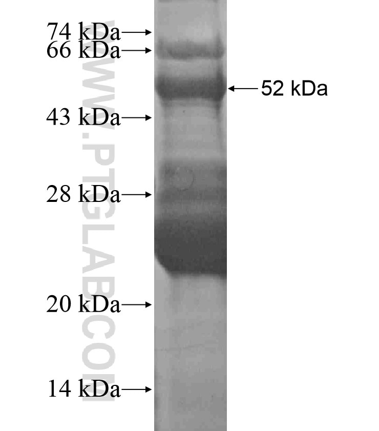 BHLHA15 fusion protein Ag18199 SDS-PAGE