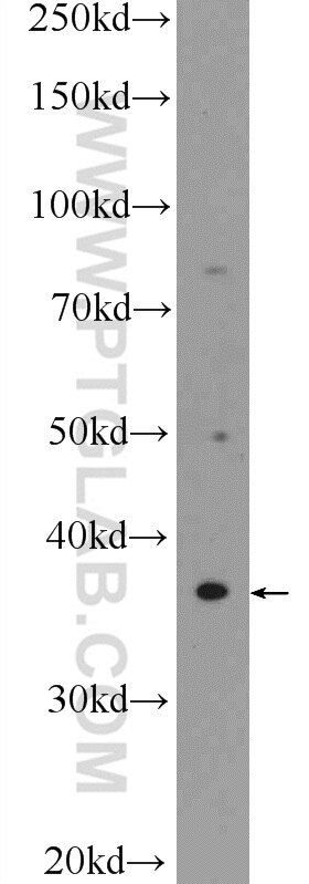 WB analysis of SH-SY5Y using 25622-1-AP